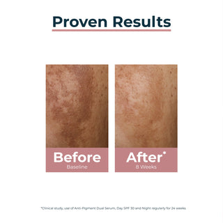 Eucerin Anti-pigment Dual Serum 30ml