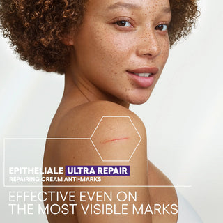 A-Derma Epitheliale A.H Ultra Repairing Cream 40ml