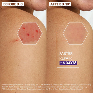 A-Derma Epitheliale A.H. Ultra Repairing Cream 100ml