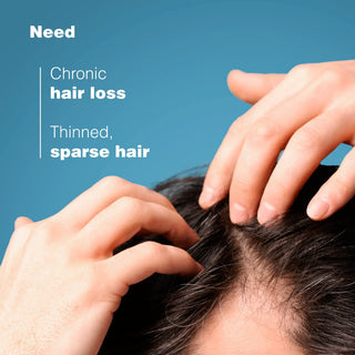 Ducray Anaphase Hair Loss Anti-Thinning Shampoo 200ml