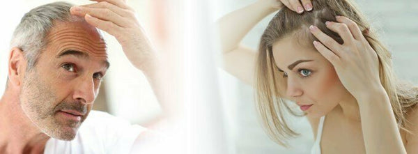 Hair Loss - Did you know that a healthy person can lose up to 100 hairs in one day?