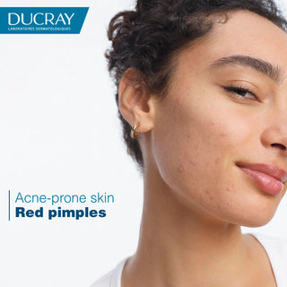 Ducray Keracnyl PP+ Anti-Blemish Cream for Oily Skin 30ml