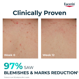 Eucerin DermoPure Clinical Body Cream 200ml