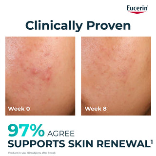 Eucerin DermoPure Clinical Renewal Care 40ml