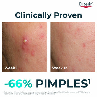 Eucerin DermoPure Clinical Triple Effect Serum 40ml