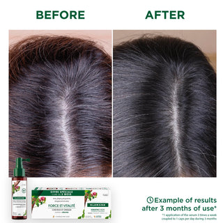 Klorane Capsules KeratinCaps Hair and Nail Loss 30 capsules