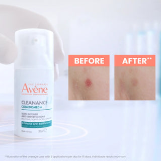 Avène Cleanance Comedomed+ Anti-Blemishes Concentrate 30ml
