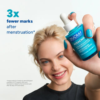 Ducray Keracnyl Serum 30ml