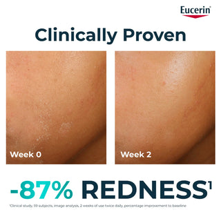 Eucerin DermoPure Clinical Soothing Cream 40ml