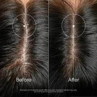 Klorane Galanga Anti-Dandruff Treatment 100ml