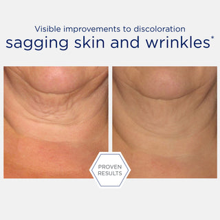 NeoStrata Skin Active Neck Lifting Cream 80g
